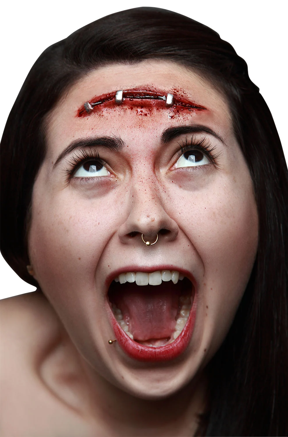 Metal Staples Prosthetic Kit 3 Metal Staples Prosthetic Kit